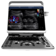CHISON EBIT30 EBIT30 Taşınabilir Renkli Doppler Ultrasonografi Cihazı