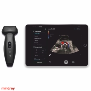 6903053035132 MINDRAY TE Air TE AİR El Tipi Renkli Doppler Ultrasonografi Cihazı