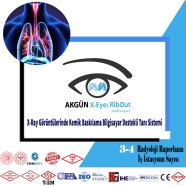 AKGÜN RIS X-Eye: RibOut Akciğer X-Ray Görüntülerinde Kemik Baskılama Sistemi ...