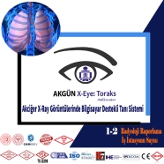 AKGÜN X-Eye:Toraks Akciğer X-Ray Görüntülerinde Bilgisayar Destekli Tanı Sist...