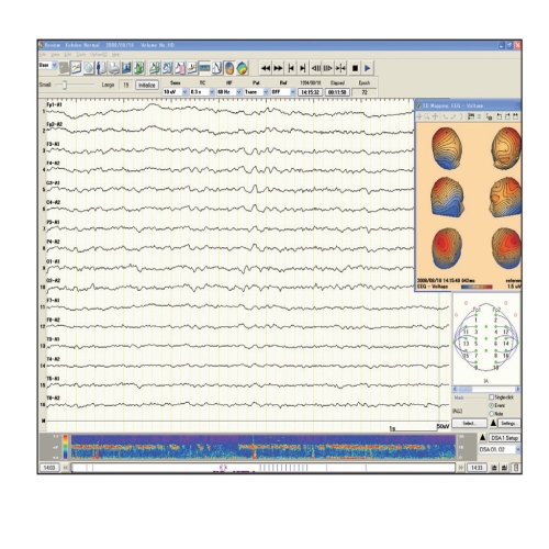 NIHON KOHDEN EEG-1200K 4931921102503 EEG-1200K EEG